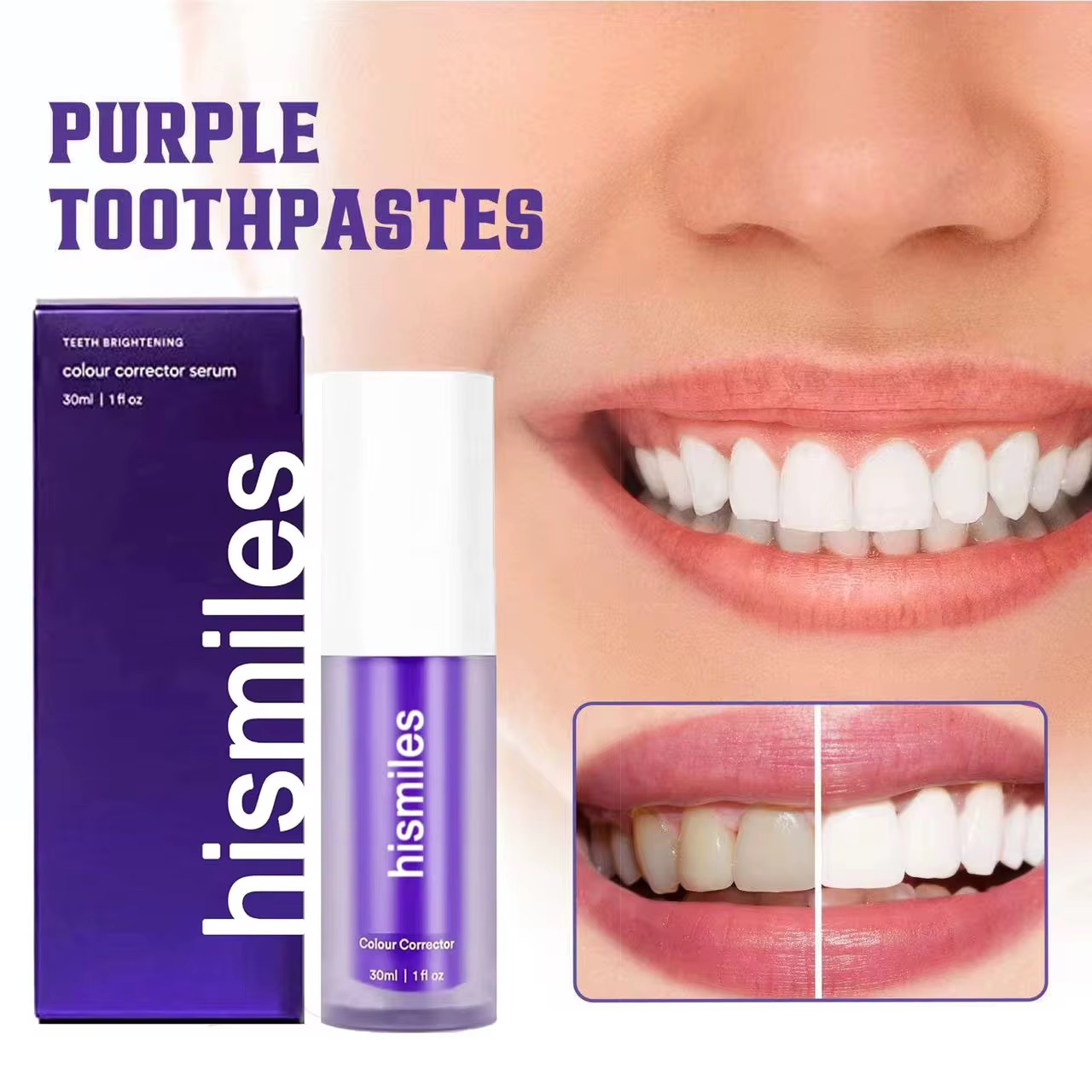 Whitening teeth